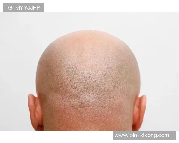 美记建议布朗剃光头更省心发际线粉不如简单直接 美记建议布朗剃光头更省心发际线粉不如简单直接